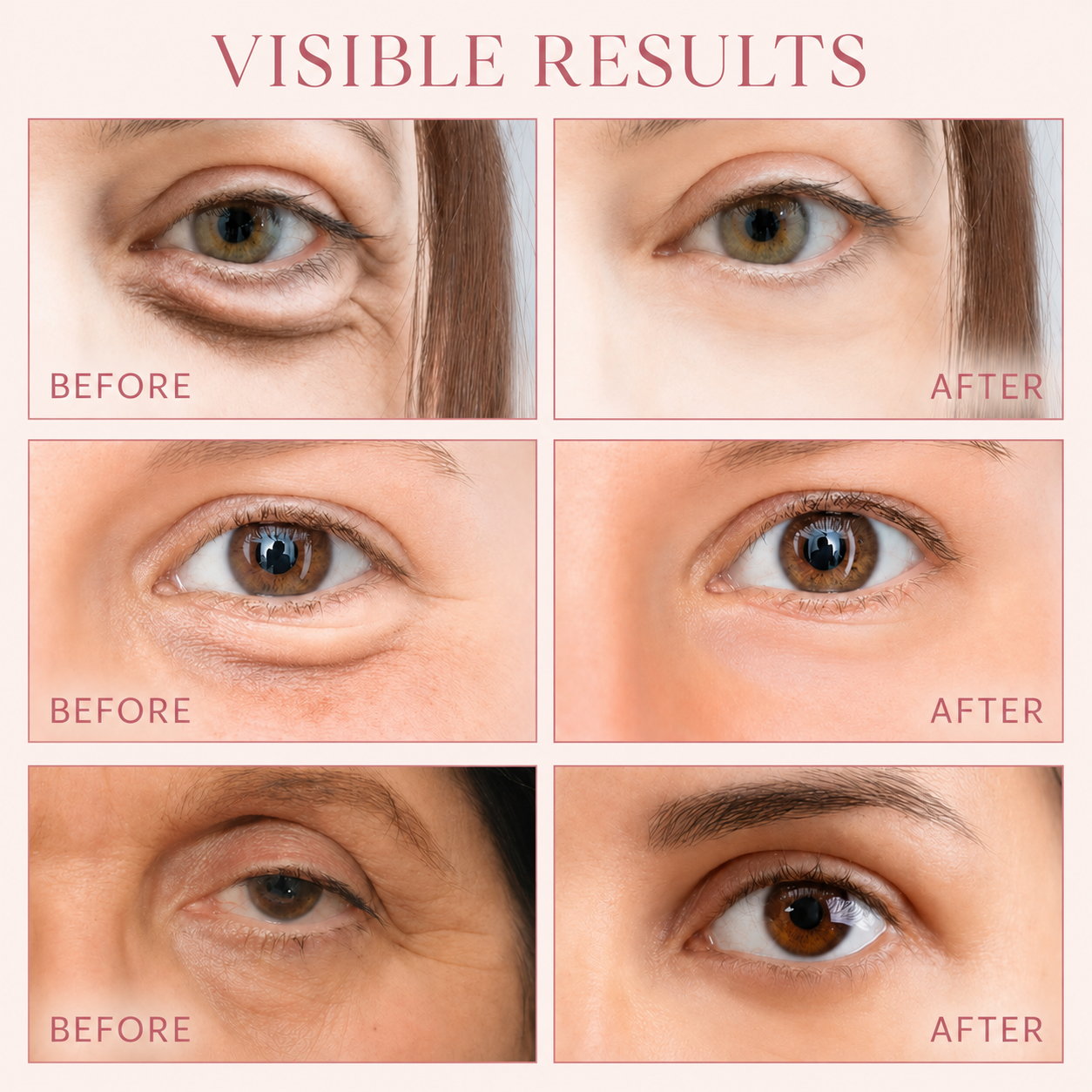 Microneedle Eye Patches — Visibly Brighter, Smoother Under-Eyes by Morning.